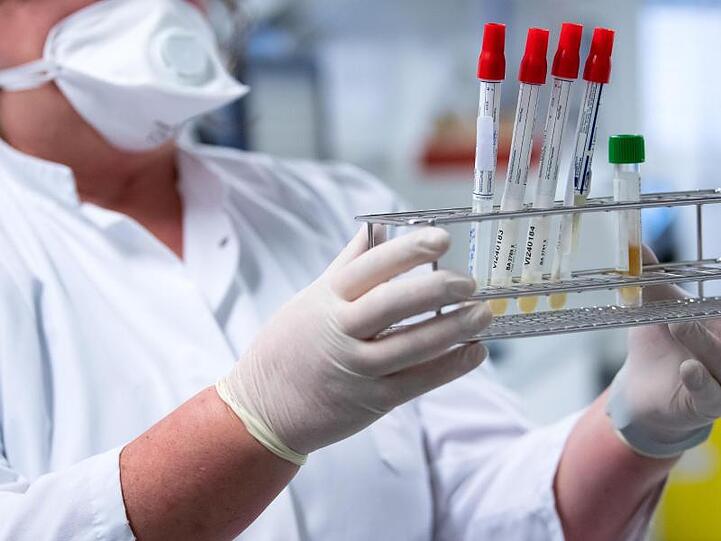 Eine Mitarbeiterin bereitet Proben von Menschen mit Covid-19 Verdacht für die weitere Analyse vor. Foto: Sven Hoppe/dpa/Symbolbild