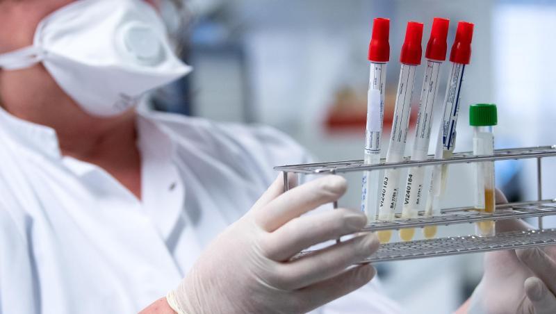 Eine Mitarbeiterin bereitet Proben von Menschen mit Covid-19 Verdacht für die weitere Analyse vor. Foto: Sven Hoppe/dpa/Symbolbild Eine Mitarbeiterin bereitet Proben von Menschen mit Covid-19 Verdacht für die weitere Analyse vor. Foto: Sven Hoppe/dpa/Symbolbild