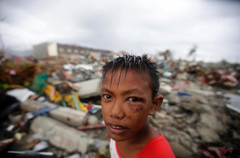 Dieser Junge aus Tacloban ist vielleicht das Gesicht, dass man von den ersten Tagen nach dem Taifun mit dem Katastrophengebiet verbindet. Er ist verletzt, hat wahrsicheinlich sein komplettes Hab und Gut verloren.