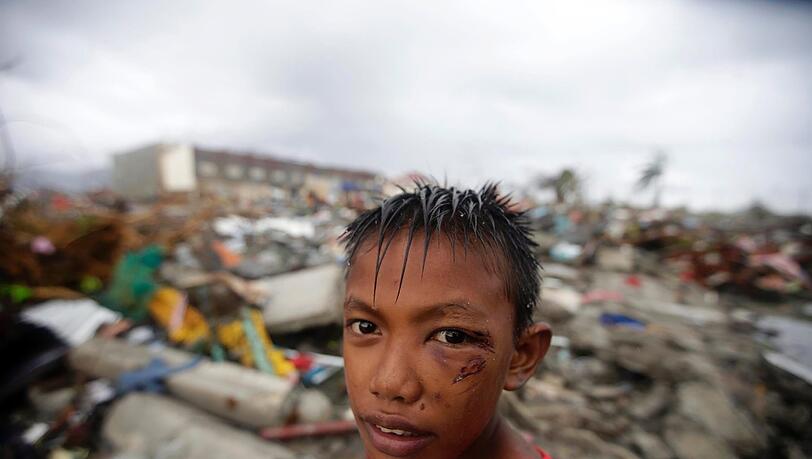 Dieser Junge aus Tacloban ist vielleicht das Gesicht, dass man von den ersten Tagen nach dem Taifun mit dem Katastrophengebiet verbindet. Er ist verletzt, hat wahrsicheinlich sein komplettes Hab und Gut verloren. Dieser Junge aus Tacloban ist vielleicht das Gesicht, dass man von den ersten Tagen nach dem Taifun mit dem Katastrophengebiet verbindet. Er ist verletzt, hat wahrsicheinlich sein komplettes Hab und Gut verloren.