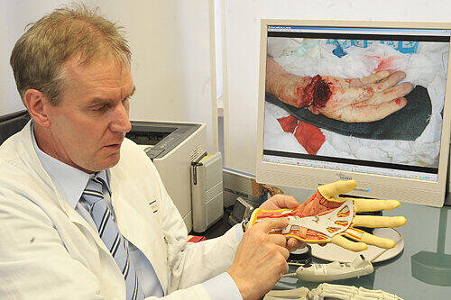 Prof. Raymund Horch zeigt ein Bild der abgerissenen Hand.