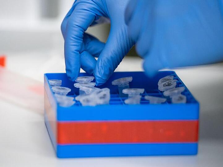 Eine Virologin untersucht Proben auf das Coronavirus. Foto: Christophe Gateau/dpa/Symbolbild