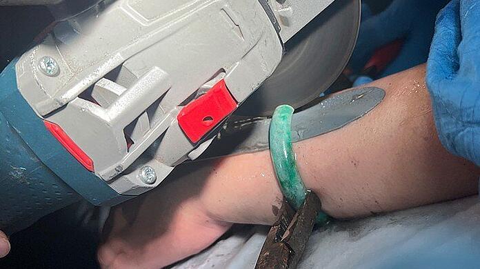 Die Münchner Feuerwehr musste einer Frau den geliebten Jadeschmuck vom Arm sägen.