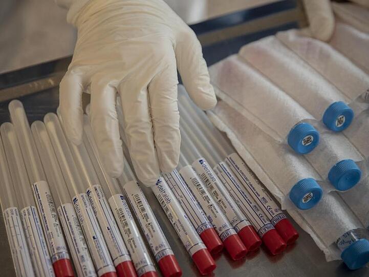 Coronavirus-Testkits. Foto: Santi Palacios/AP/dpa/Symbolbild