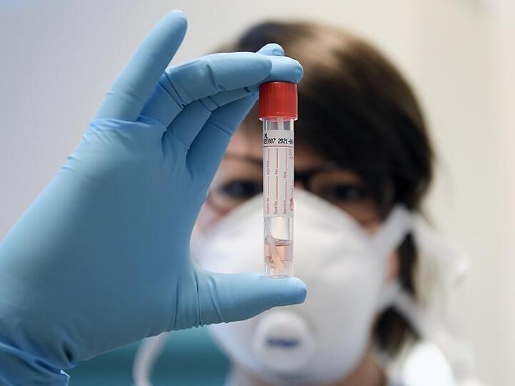 Laut Kassenärztlicher Vereinigung dauert es aktuell fünf bis sieben Tage, ehe das Ergebnis eines Corona-Tests vorliegt. Foto: Hans Klaus Techt/APA/dpa/Symbolbild