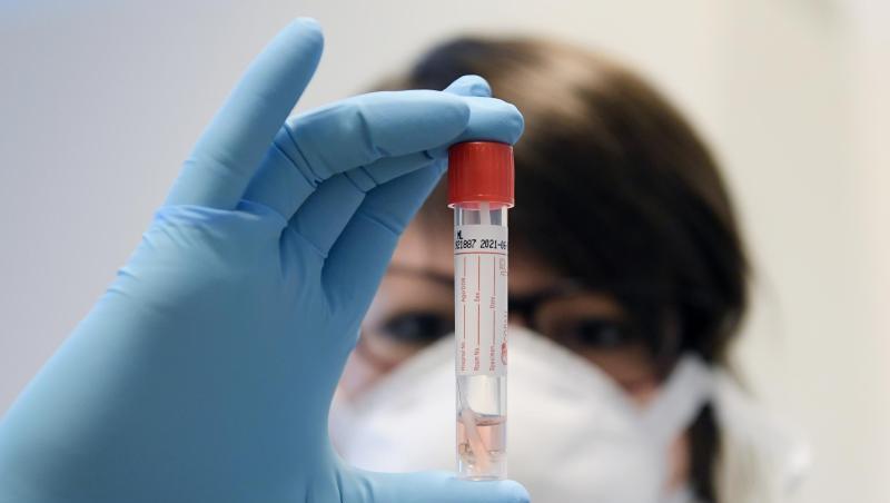 Laut Kassenärztlicher Vereinigung dauert es aktuell fünf bis sieben Tage, ehe das Ergebnis eines Corona-Tests vorliegt. Foto: Hans Klaus Techt/APA/dpa/Symbolbild