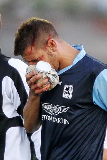 Beim 0:0 im Test gegen Austria muss Guillermo Vallori mit viel Blut am Kopf vom Feld. Die Löwen-Fans befürchten schnell schlimmstes &ndash; Trainer Maurer aber bleibt gelassen. Sehen Sie hier die Bilder.