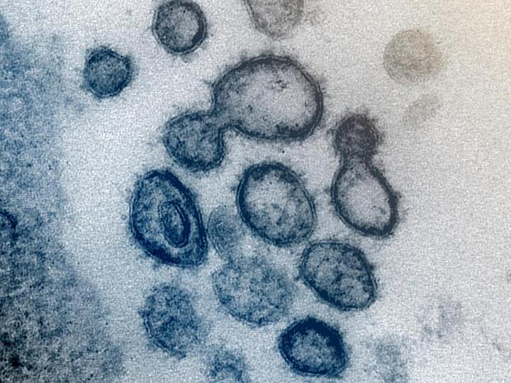 Das neuartige Coronavirus SARS-CoV-2 unter dem Elektronenmikroskop. Foto: Uncredited/NIAID-RML/AP/dpa/Archivbild