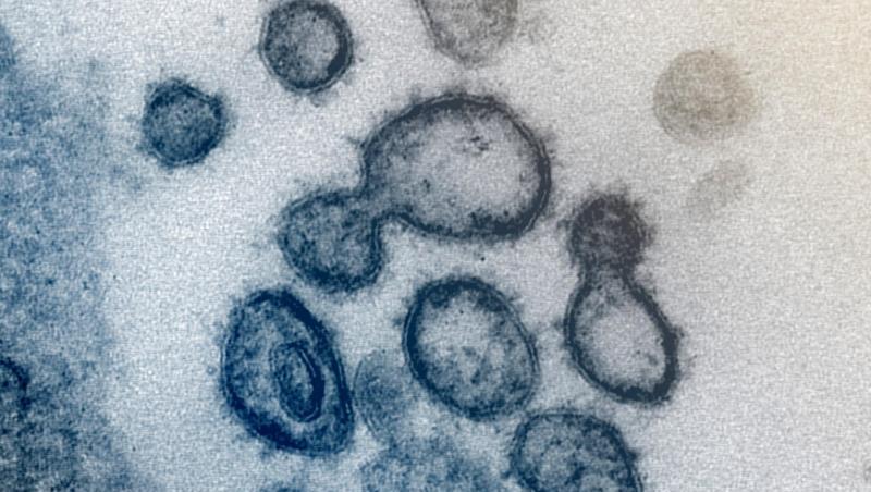 Das neuartige Coronavirus SARS-CoV-2 unter dem Elektronenmikroskop. Foto: Uncredited/NIAID-RML/AP/dpa/Archivbild Das neuartige Coronavirus SARS-CoV-2 unter dem Elektronenmikroskop. Foto: Uncredited/NIAID-RML/AP/dpa/Archivbild