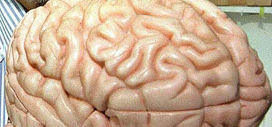 Warum sammelt sich der Alzheimer-Stoff im Gehirn?