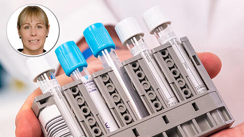 Roche bringt einen belastbaren Antikörpertest auf den Markt &ndash; made in Bavaria.