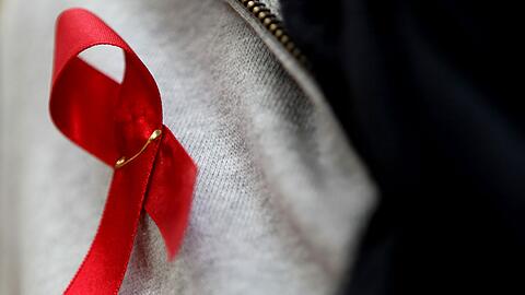 Im Gesundheitsreferat gibt es Beratung zu sexuell übertragbaren Krankheiten, einschließlich Aids.