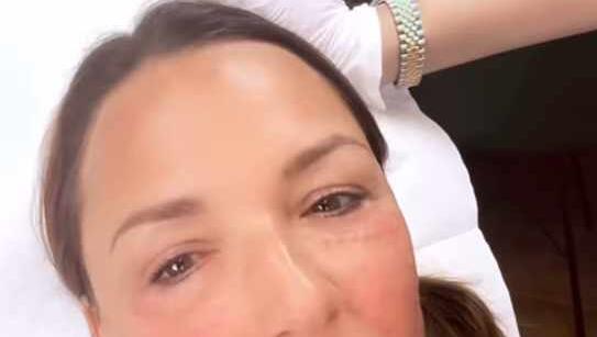 Via Instagram nimmt Simone Ballack ihre Follower mit zur Beauty-Behandlung. Via Instagram nimmt Simone Ballack ihre Follower mit zur Beauty-Behandlung.