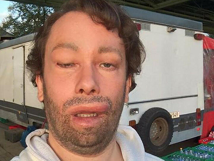 Christian Ulmen zeigt sich nicht nur von seiner besten Seite