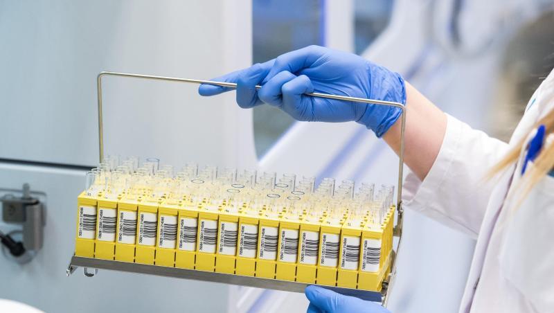 Laut dem MDR sollen die Bundesliga-Profis alle drei Tage auf eine mögliche Infektion mit dem Coronavirus getestet werden. Laut dem MDR sollen die Bundesliga-Profis alle drei Tage auf eine mögliche Infektion mit dem Coronavirus getestet werden.