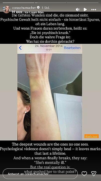 Cora Schumacher meldet sich via Instagram mit einem auffälligen Posting zurück. Zu sehen ist ein verletztes Handgelenk. Cora Schumacher meldet sich via Instagram mit einem auffälligen Posting zurück. Zu sehen ist ein verletztes Handgelenk.