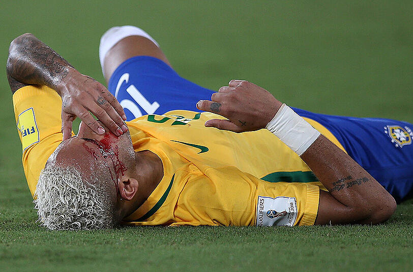 Die Neymar-Show beim 5:0 (4:0) im WM-Qualifikationsspiel gegen Bolivien fand nach einem Ellbogen-Stoß ihr spektakuläres, blutiges Schlussbild.