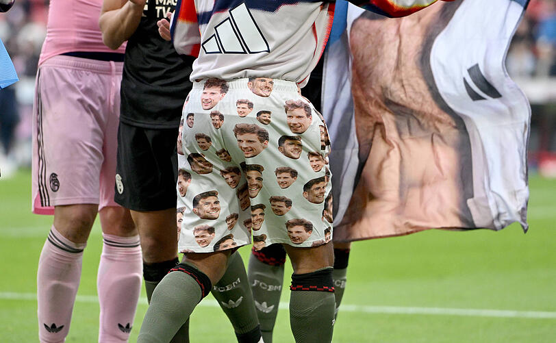 Auf der Hose, die sich Serge Gnabry von einem Fan geliehen hatte, sind zahlreiche Gesichter von FCB-Kollege Leon Goretzka zu sehen.