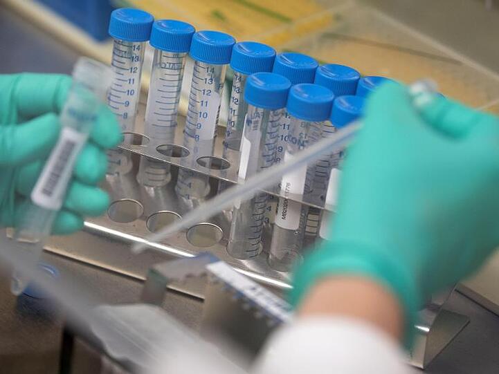 Eine Mitarbeiterin des Landesgesundheitsamts Baden-Württemberg pipettiert Proben.
