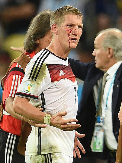 Der blutende Schweinsteiger führte die DFB-Elf 2014 zum Titel. Dieses Bild ging um die Welt.